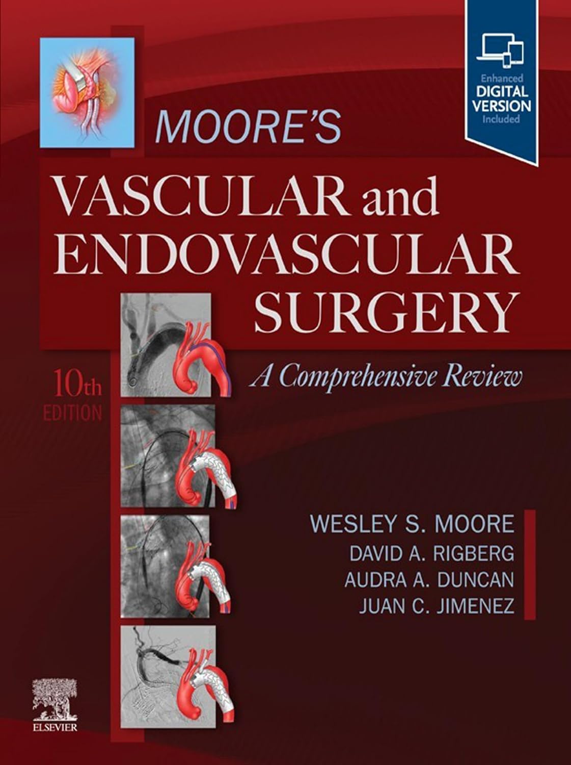Moore's Vascular and Endovascular Surgery A Comprehensive Review - E-Book Moore's Vascular and Endovascular Surgery A Comprehensive Review - E-Book